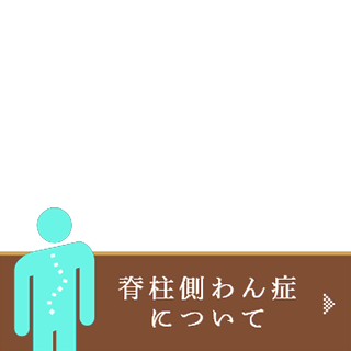 脊柱側弯症について