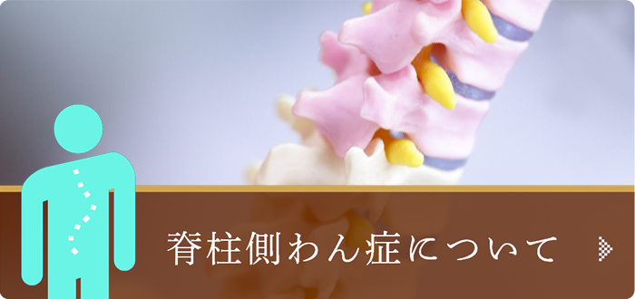 脊柱側弯症について
