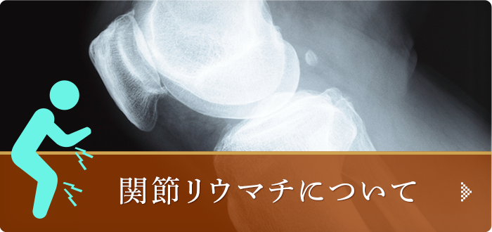 関節リウマチについて